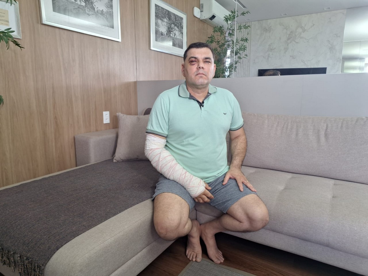 Richard Bastani, de 50 anos, se recupera das agressões sofridas em bar de BH