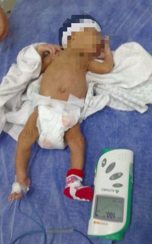 Bebê prematuro de 29 dias engasga e é salvo pelo SAMU em Coração de Jesus