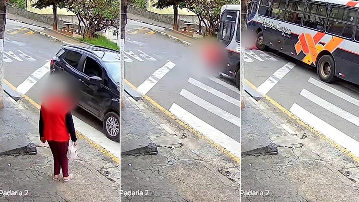 Idosa perdeu as duas pernas após ser atropelada na faixa de pedestres 