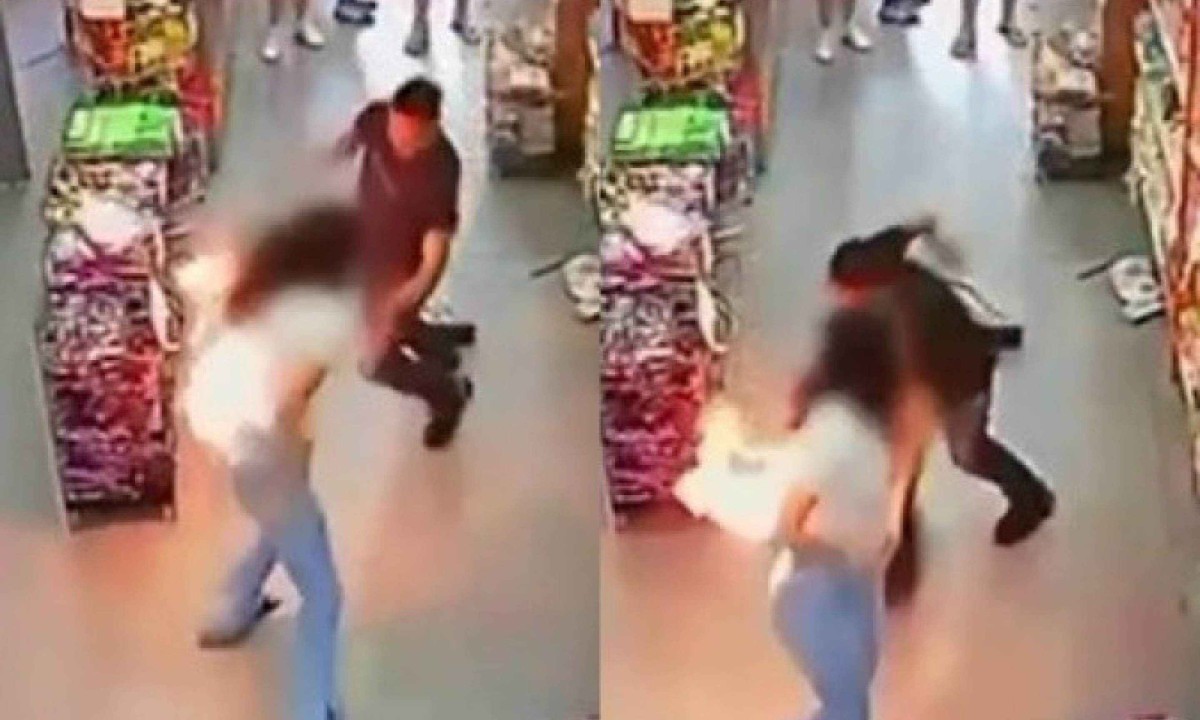 Mulher sofreu queimaduras de 1º e 2º graus após celular explodir em seu bolso 