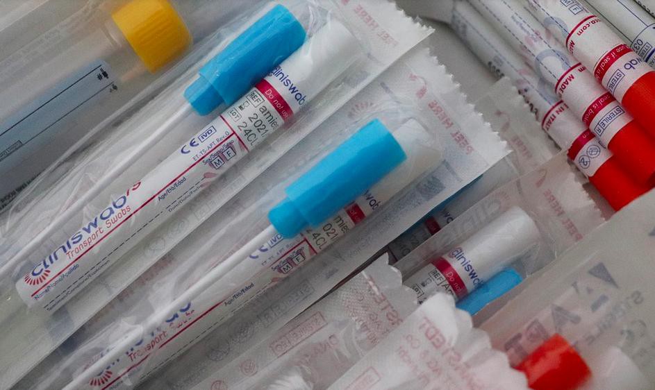 Testes do tipo RT-qPCR foram adquiridos pelo governo federal