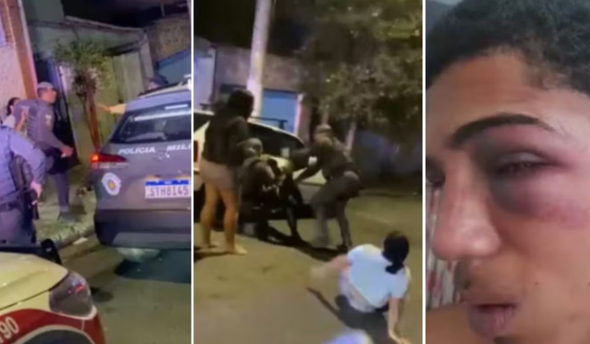 O rosto do jovem ficou inchado, seu olho esquerdo ficou roxo e há ainda marcas de agressão na boca
