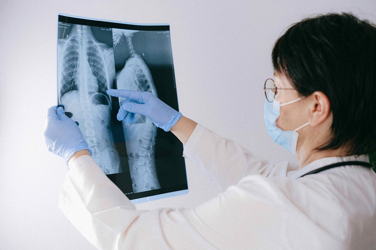 Imagem ilustrativa de uma médica observando resultados de exame na coluna
