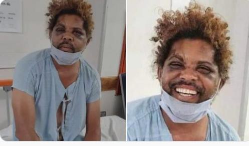 Morador em situação de rua foi levado ao hospital após ser espancado no DF