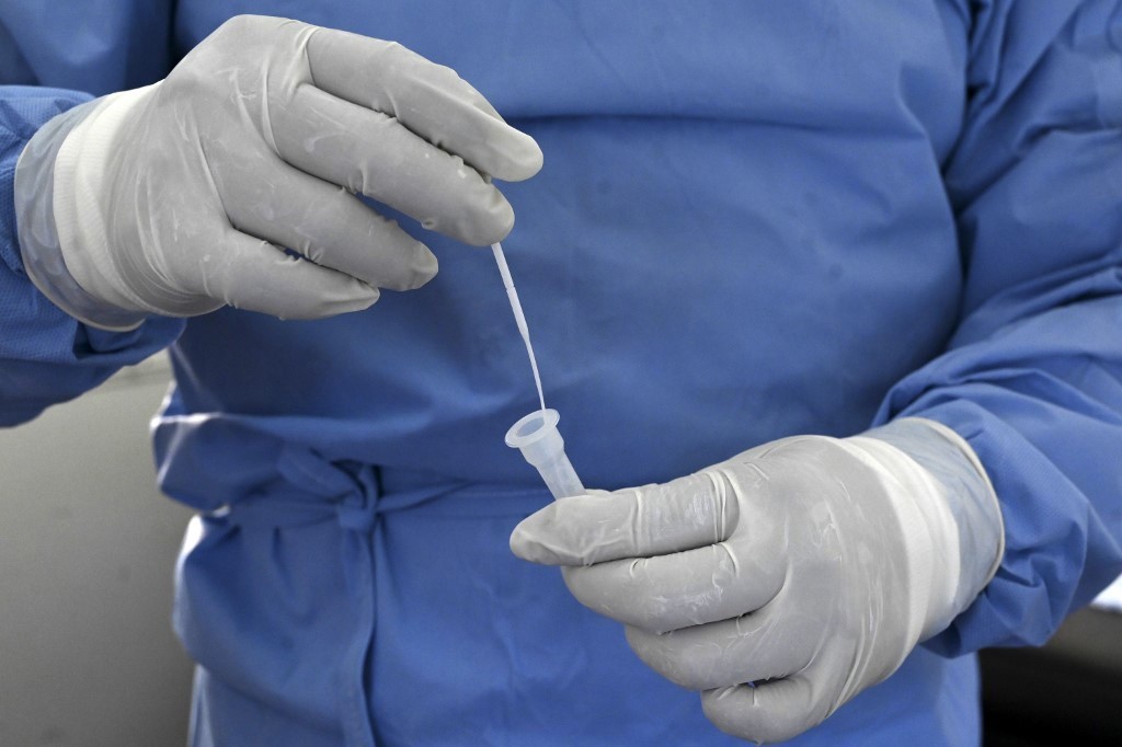 Profissional de saúde manipula teste de Covid-19