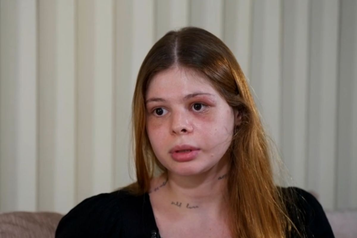 Namorado fisiculturista quebrou ossos da face da médica Samira Khouri durante ataque que durou seis minutos. Agressão causou paralisia facial e perda parcial da visão.