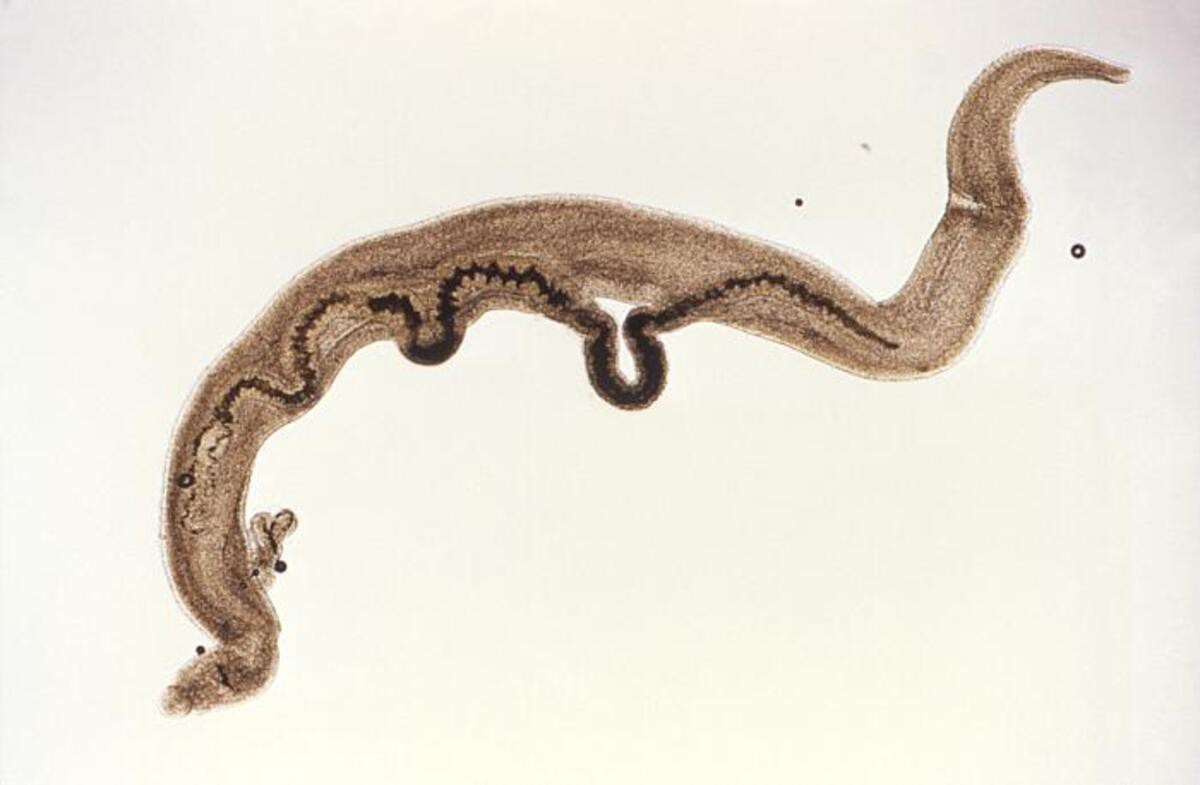 O verme Schistosoma mansoni, causador da esquistossomose