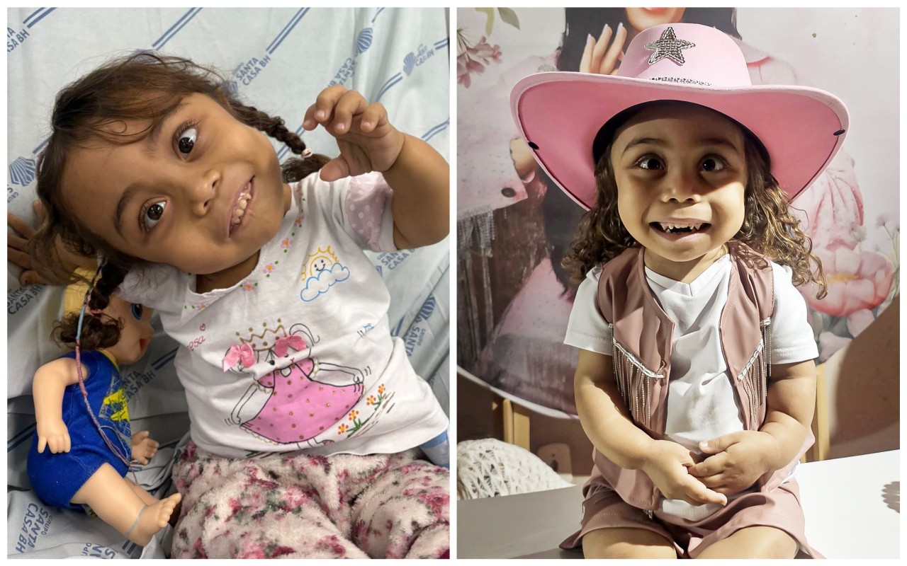 Há um ano, Alana Vitória, de 5 anos, está na fila de espera por um transplante