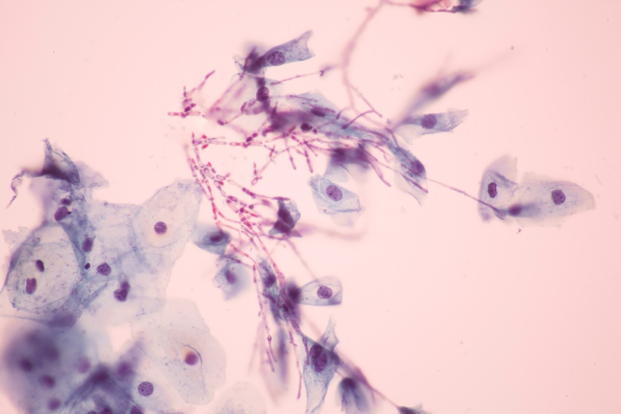 Candida, pseudohyphae form view in microscopic.Medical background.
