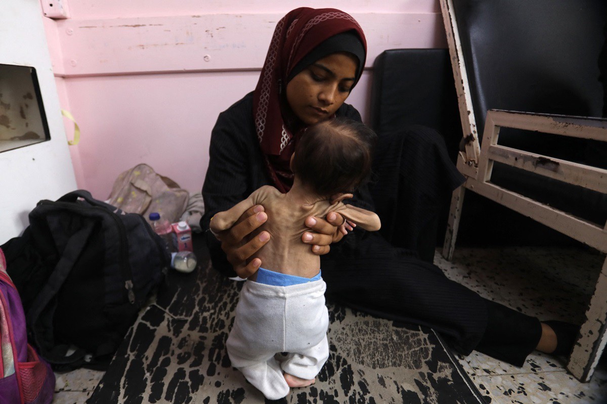 Atuação de Israel faz fome se alastrar entre população palestina de Gaza