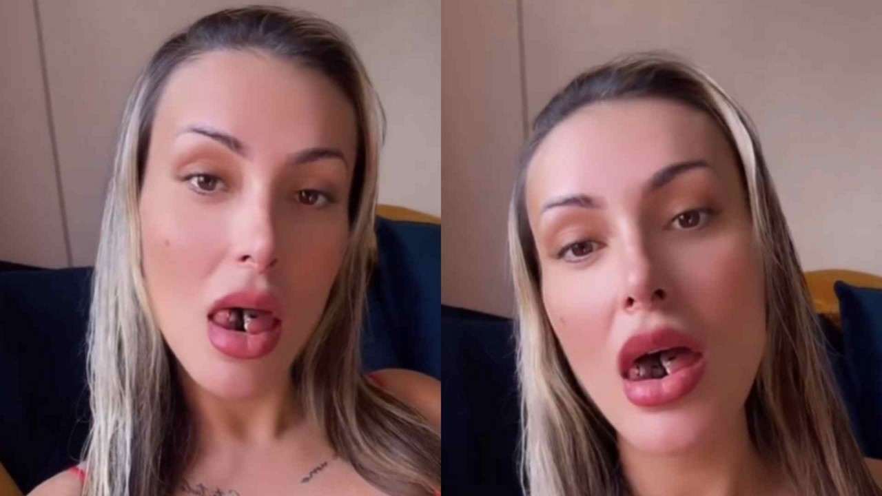 A modelo Andressa Urach após passar por uma cirurgia de bifurcação na língua
