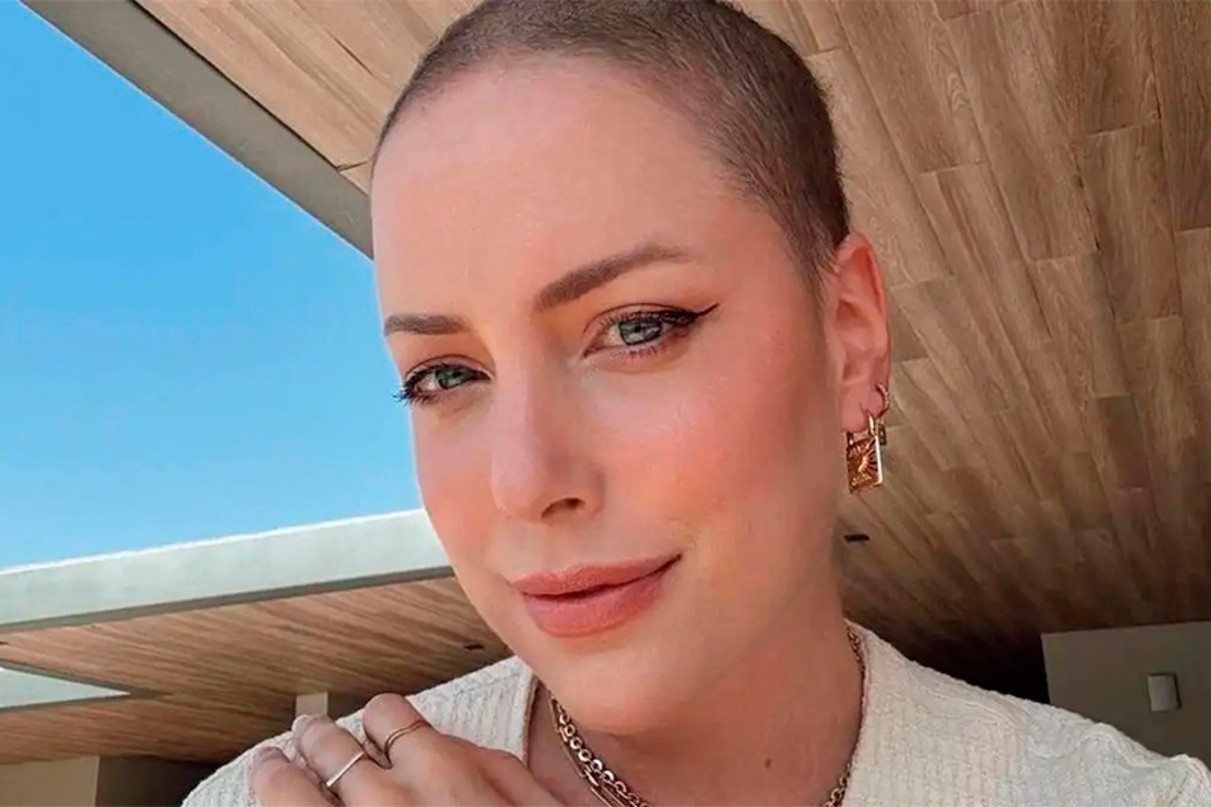 Fabiana Justus revela reação a tratamento contra a leucemia 