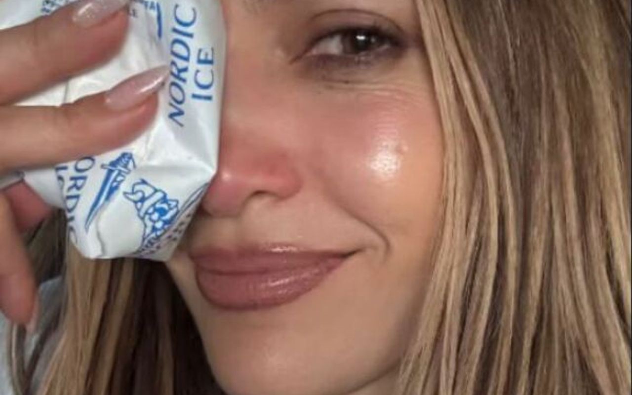 Jennifer Lopez sofre acidente 