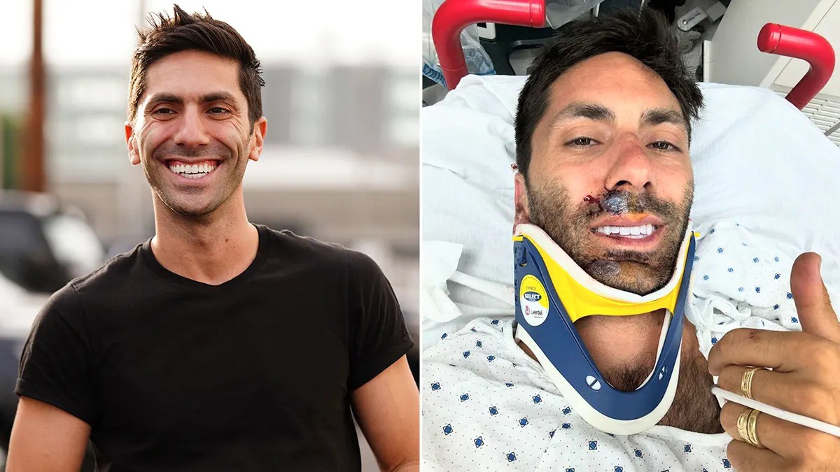 O apresentador Nev Schulman, da MTV, teve seu pescoço quebrado após ser atropelado por um caminhão