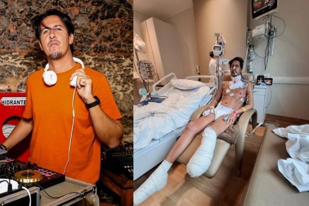 DJ Julio Andrade sofreu múltiplas amputações