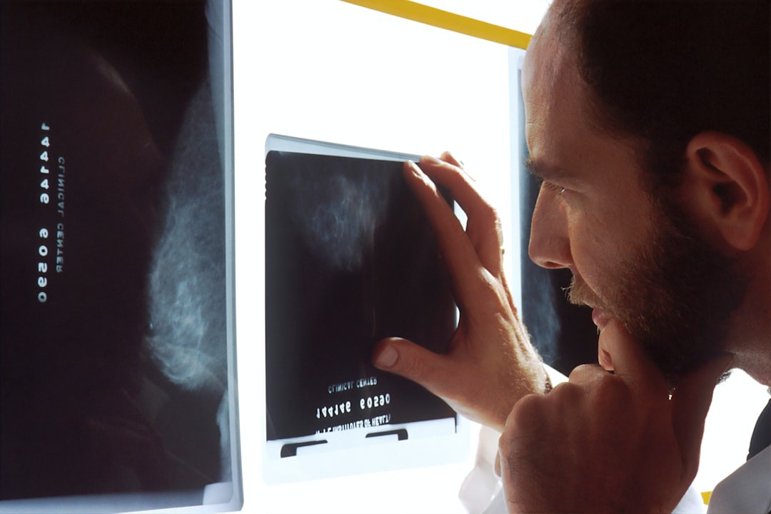 Nova terapia no câncer de próstata reacende esperança de evitar exame de toque no futuro