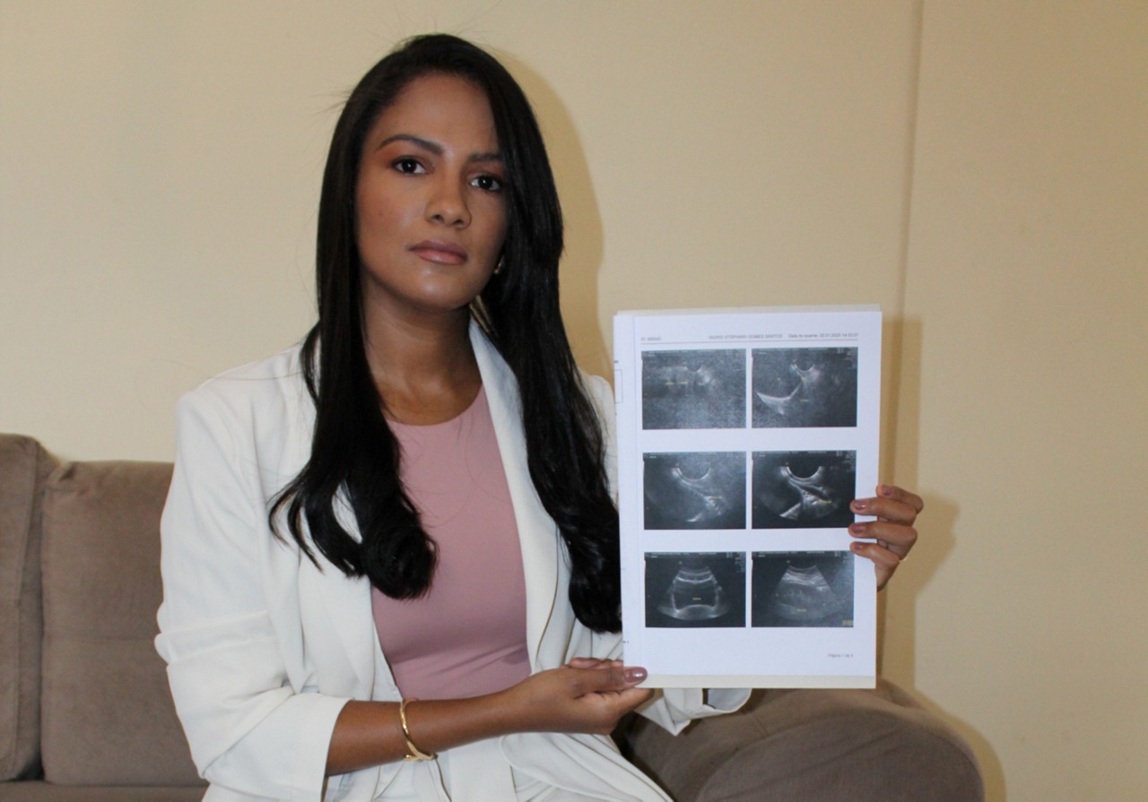 Ingrid Santos precisou passar por cirurgia para tratar a endometriose