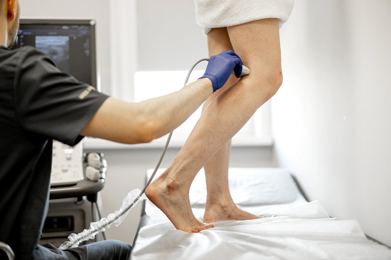 Trombose é mais comum nos membros inferiores, mas pode acontecer em outras partes do corpo