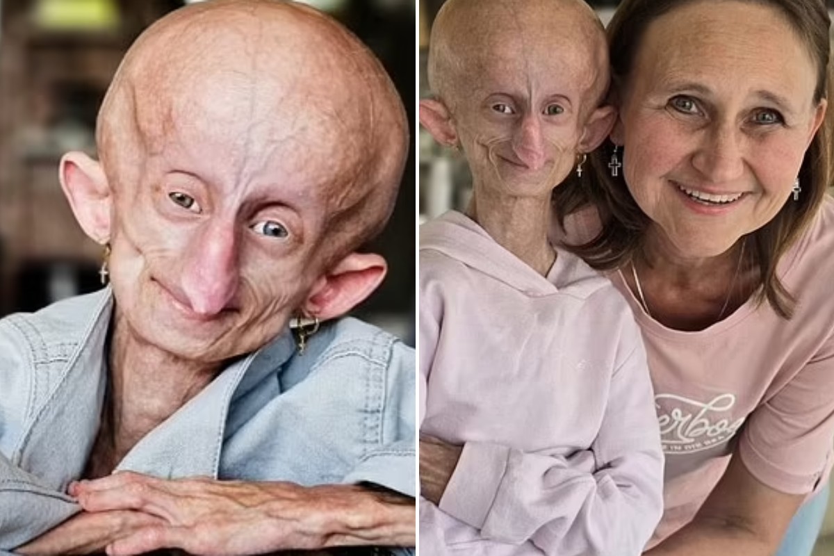 Beandri Booysen e sua mãe, Bea