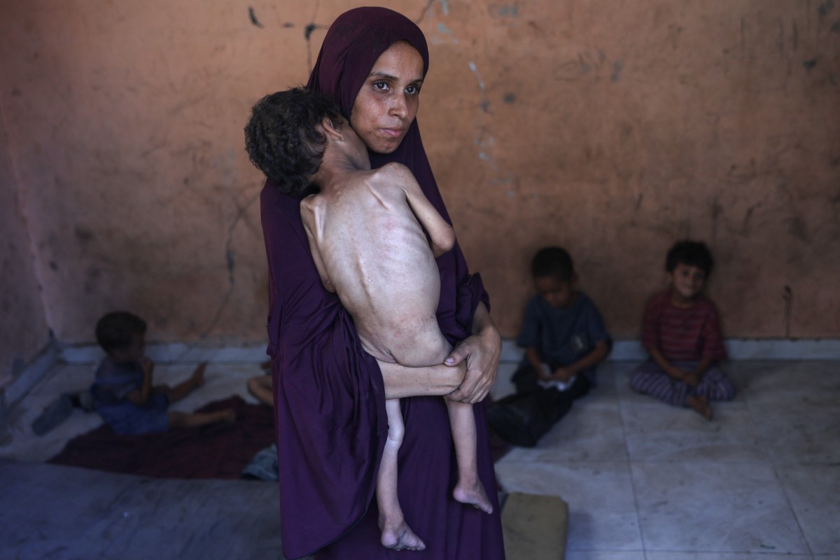 Palestina segura seu filho desnutrido de 2 anos, na Faixa de Gaza