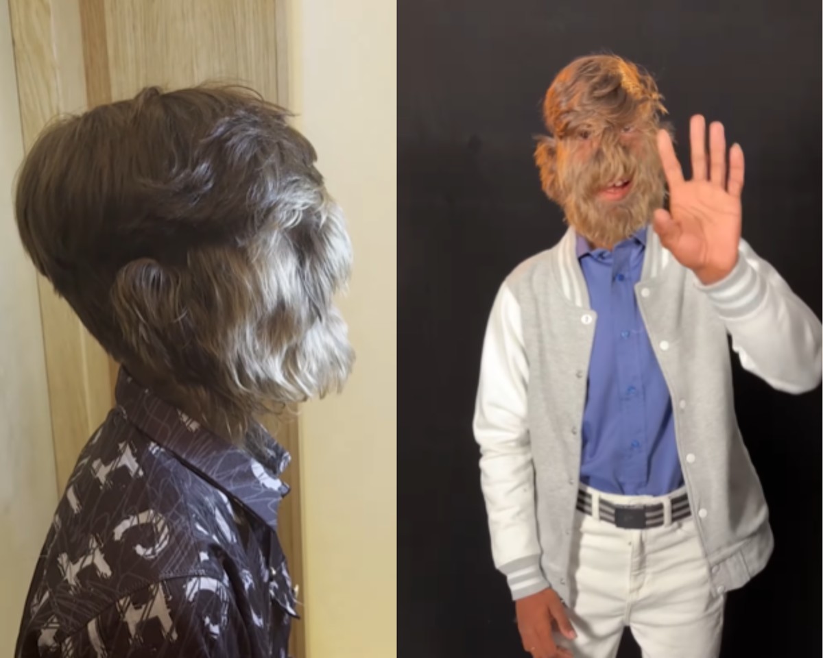 Lalit Patidar, um jovem de 18 anos da Índia, conquistou lugar no Guinness World Records por ter o rosto mais peludo do mundo