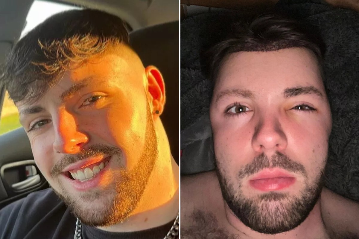 Ruben decidiu compartilhar sua experiência como forma de alertar outras pessoas