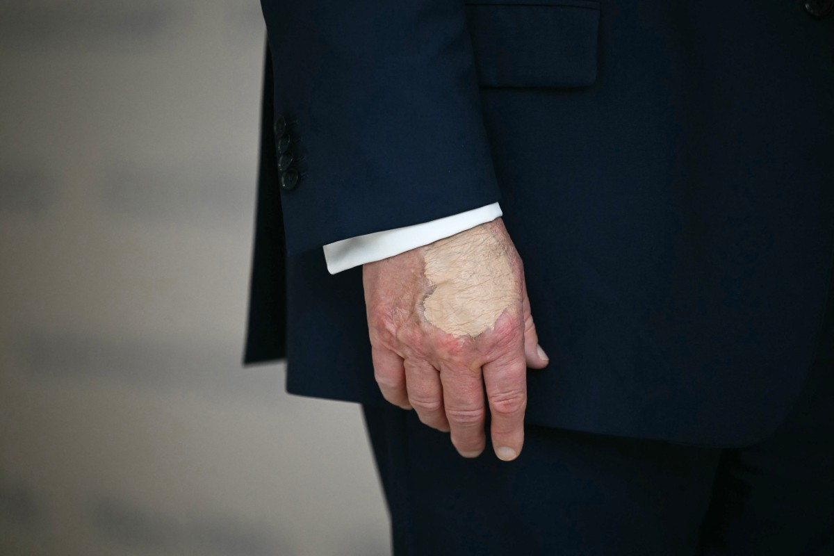 A mão do presidente dos EUA, Donald Trump