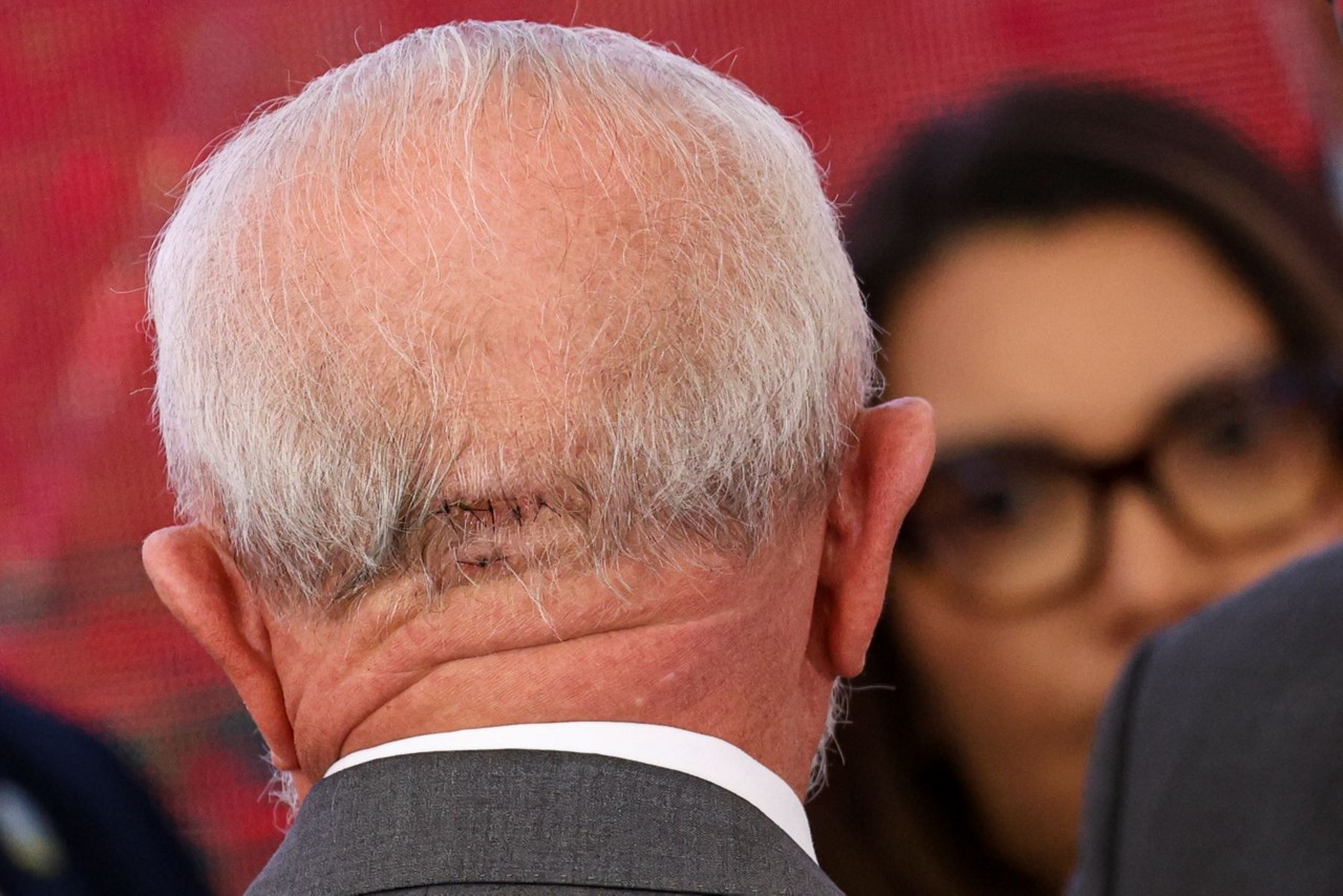 Presidente Lula retoma agenda após acidente que causou corte na nuca