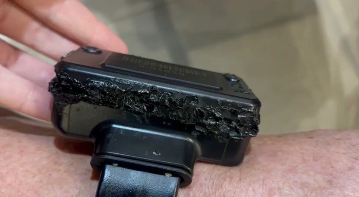 Bolsonaro diz que tentou romper tornozeleira com ferro de solda