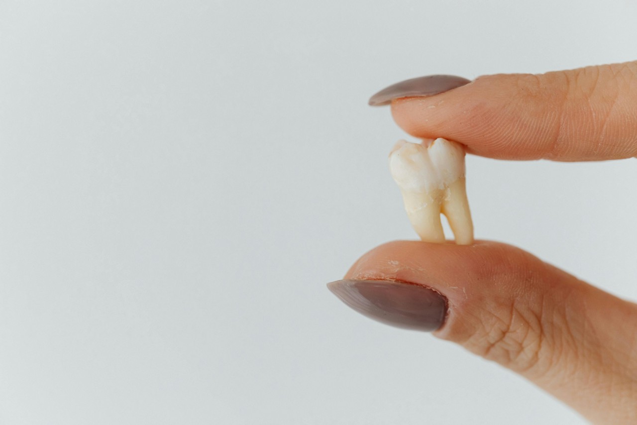 O canino utilizado na cirurgia foi apelidado de "dente do olho" (Imagem ilustrativa)
