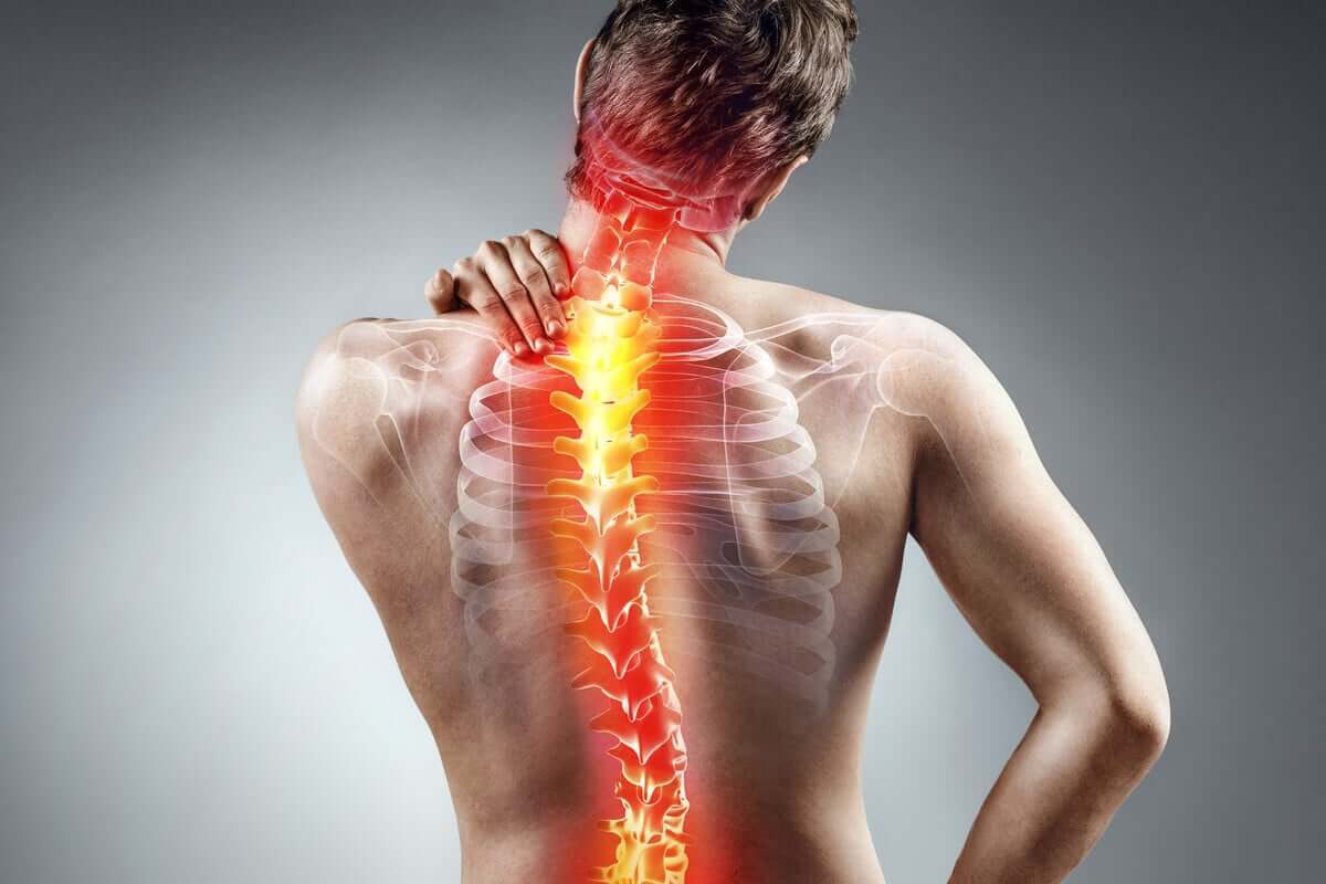 A escoliose é a curvatura anormal da coluna vertebral, mas pode ser detectada e tratada precocemente para evitar complicações