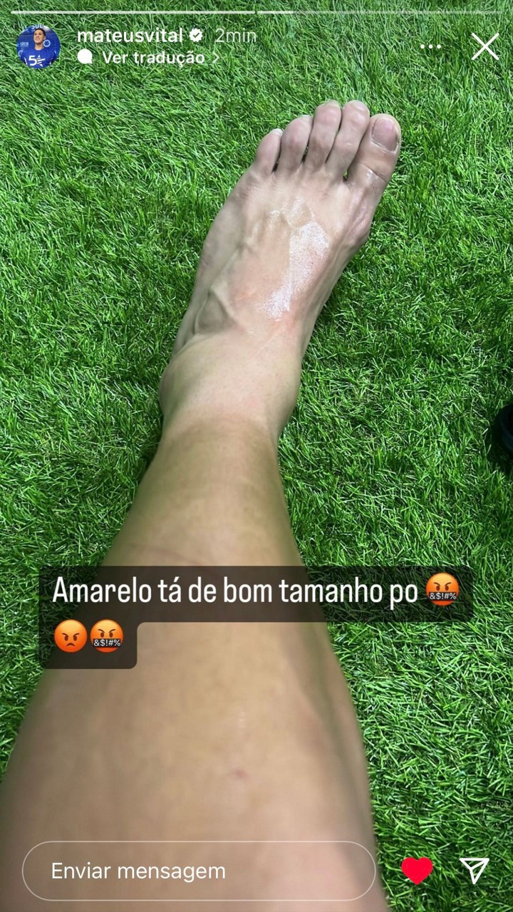 Jogador do Cruzeiro posta foto do tornozelo inchado e demonstra irritação com o árbitro do jogo