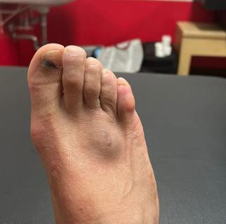 Neymar postou foto do pé lesionado