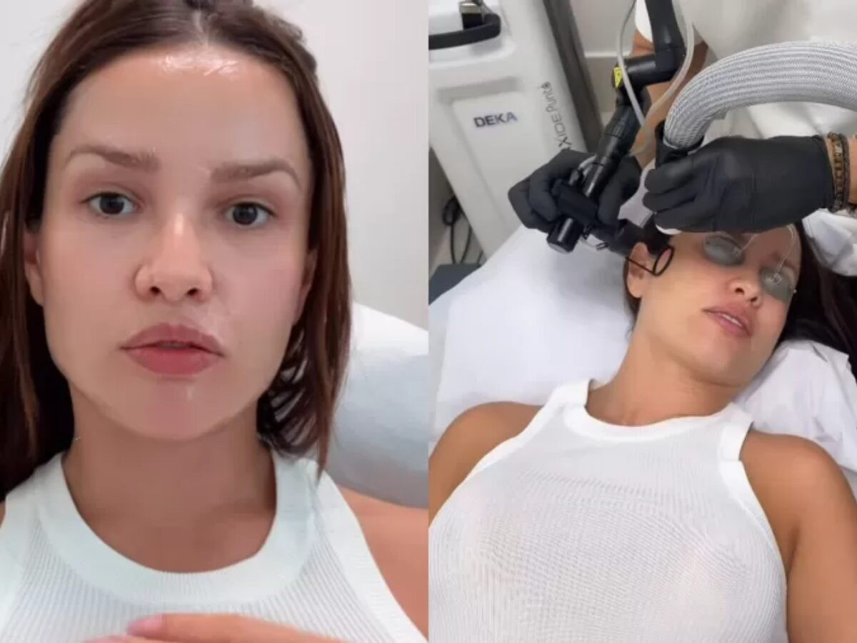 Juliette mostra rosto após procedimentos estéticos com esperma de salmão